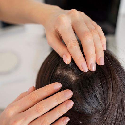 تساقط الشعر عند الأطفال: الأسباب الشائعة وطرق العلاج الفعّالة 