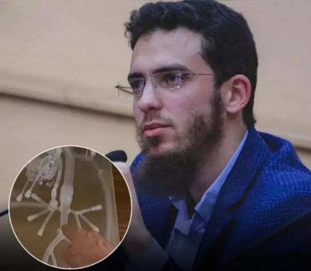 ابتكار مغربي يفتح آفاقاً جديدة في الطب.. اليابان تمنح براءة اختراع لجهاز لتصفية الدم داخل الأوعية للدكتور يوسف العزوزي    