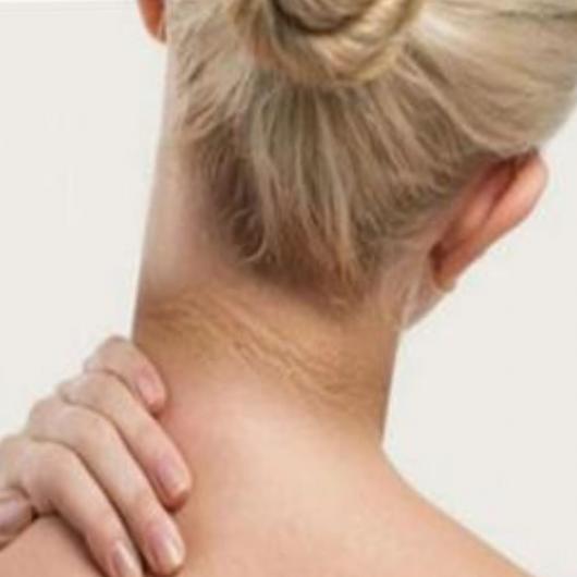 هذه هي أسباب سواد الرقبة    