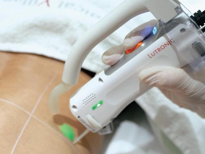    تقنية Clarity II… تجربة متطورة تمنحك بشرة ناعمة بثقة عالية  