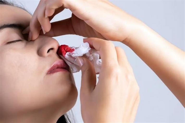 نزيف الأنف المفاجئ أثناء النوم: عرض عابر أم إنذار صحي يجب الانتباه له؟