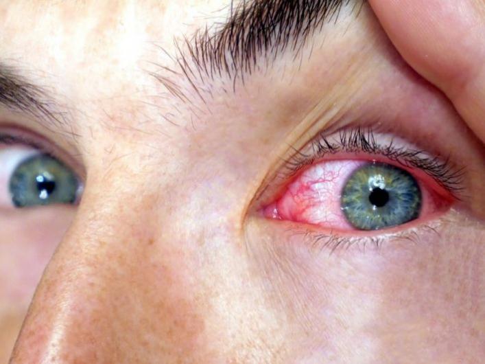 
                                    مرض شبكية العين ... تشخيص مبكر وعلاجات تحمي نعمة البصر   