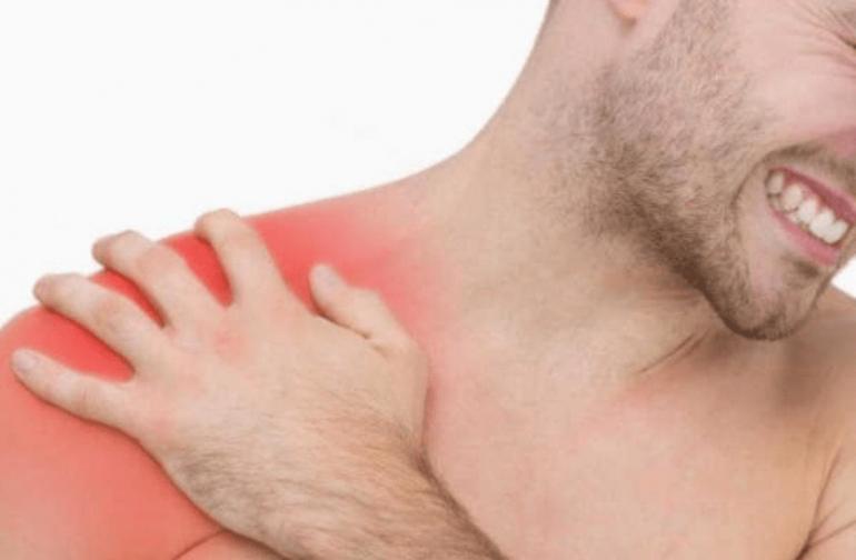 التهاب الكتف : الألم الخفي الذي يعيق حياتك اليومية   