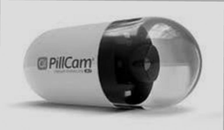 الكبسولة الإندوسكوبية… ثورة طبية صغيرة بحجم حبة دواء تكشف أسرار الجهاز الهضمي   